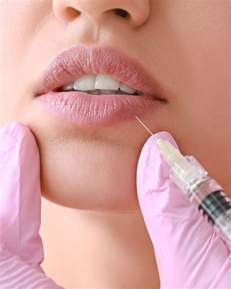 Can you get Botox around your Mouth? - the daily glimmer