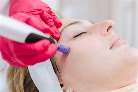 Micro-Needling | Skin Rejuvenation | SkinPen in San Antonio TX