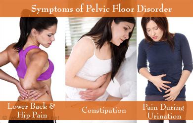 What is Pelvic Floor Dysfunction? - Health Engagement