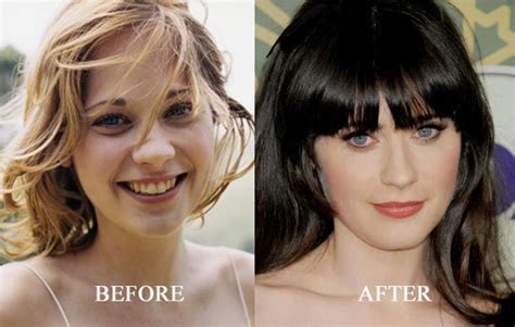 Extreme Plastic Surgery, Celebrity Plastic Surgery, Photoshop, Zooey ...