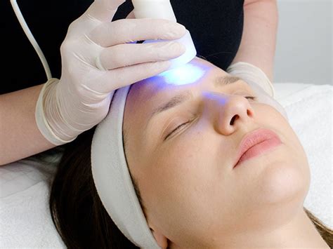 LED Therapy Devices: The Natural Solution for Acne