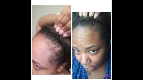 Wild Hair Growth Oil Before And After