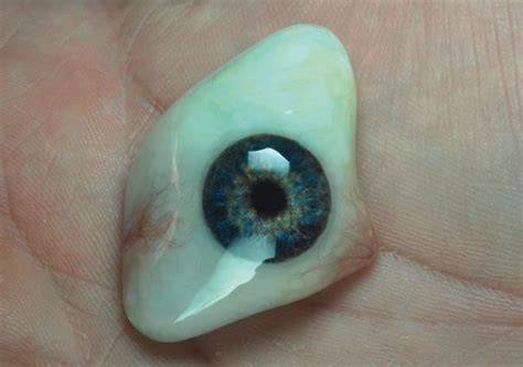 A scleral shell eye conformer type of prosthesis | Prosthetics, Parts of the eye, Ocular prosthesis