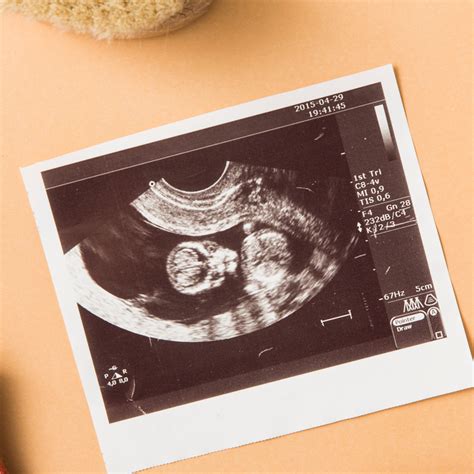 How Do Dating Ultrasounds Work – Telegraph