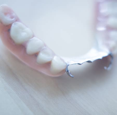 Metal Dentures | Denture 4 You