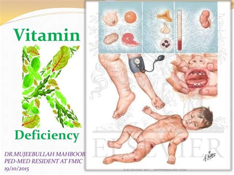 Vitamin k deficiency