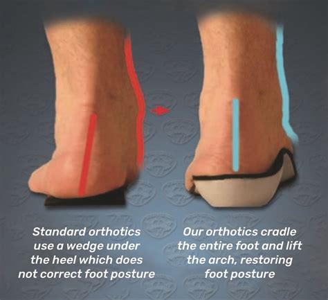 How To Relieve Arthritis In Feet - ArthritisDaily.net