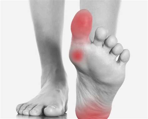 Types of Arthritis that Affect Your Feet - Lucky Feet Shoes