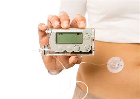 Get in the Know: Continuous Glucose Monitors (CGM) and Insulin Pumps