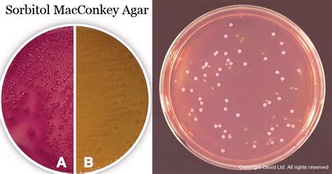 Sorbitol Macconkey Agar Culture Media Microbe Notes | Free Nude Porn Photos