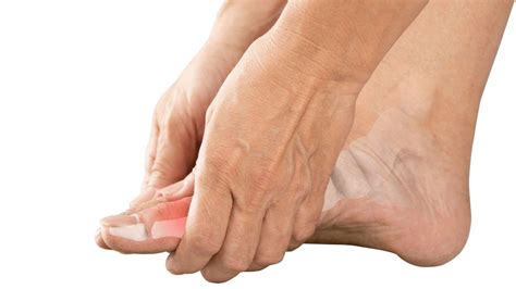 Osteoarthritis: Symptoms, Causes & Treatment | The Feet People Podiatry