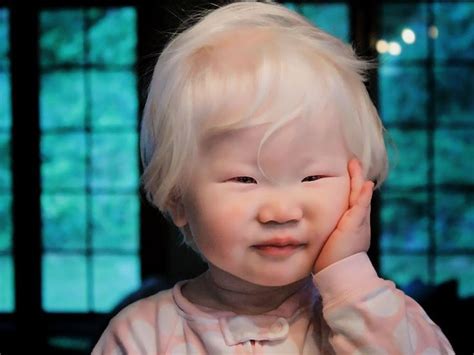 Elora | Interessante gesichter, Albino mensch, Foto kinder