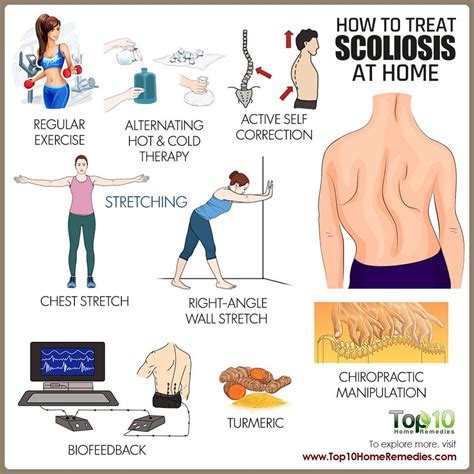 how to treat scoliosis | Scoliosis, Top 10 home remedies, Home remedies