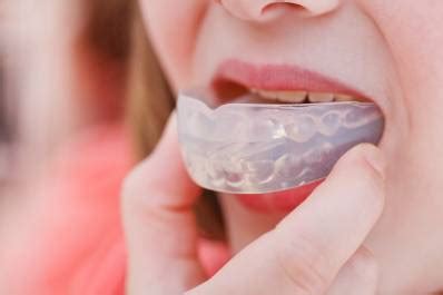 Night Mouth Guard for TMJ: Does It Work? | UtoDent.com