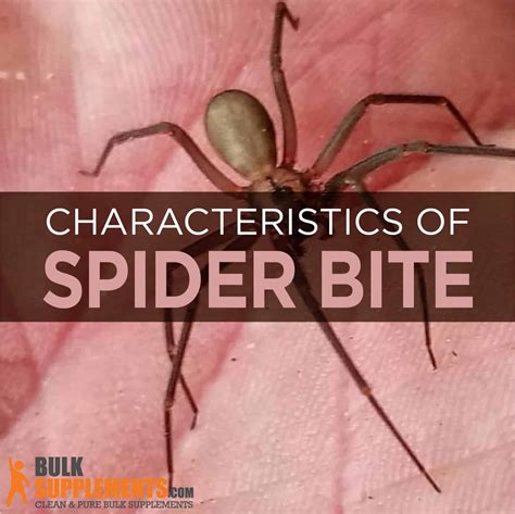 Spider Bite: Characteristics, Causes & Treatment by James Denlinger