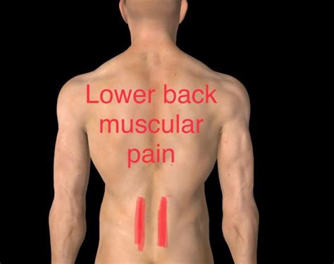 Back Pain: Anatomy & Injury Information | Body Works Physiotherapy