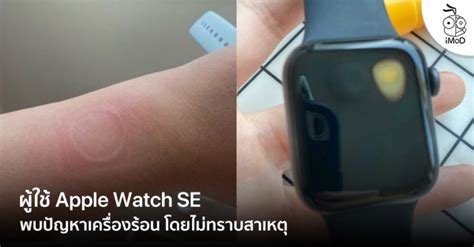 ผู้ใช้ Apple Watch SE บางราย พบปัญหาเครื่องร้อนโดยไม่ทราบสาเหตุ