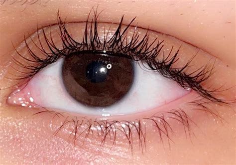 distichiasis : r/eyes