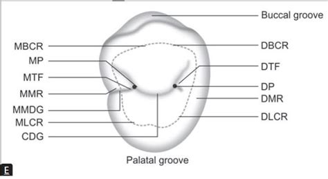 permanent maxillary premolars l tooth crown & root morphology MCQs for dental students - WikiDentia