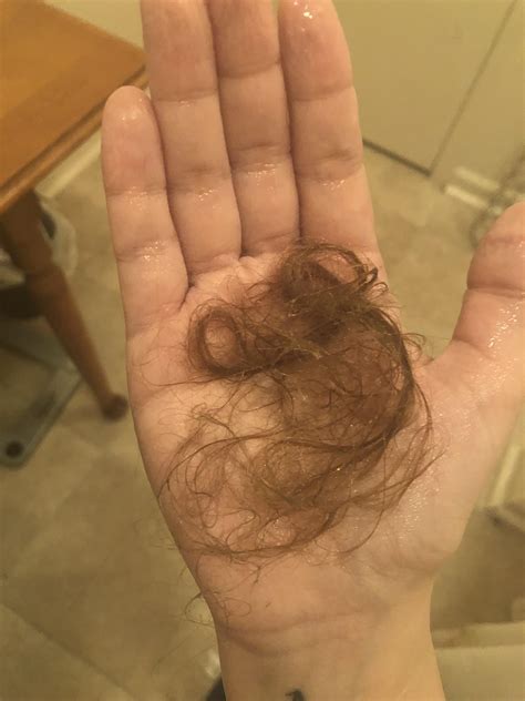 Is this normal shedding? Info below. : r/Hair