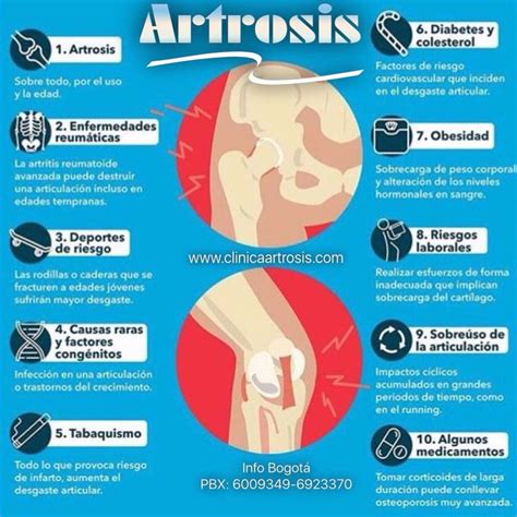 86 best images about Artrosis y Artritis on Pinterest