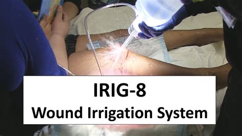 IRIG-8 Wound Irrigation System Trial - YouTube