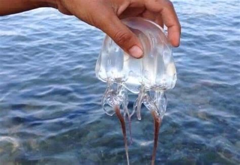 Box jellyfish sting sends 11-year-old boy to hospital in Tuburan | Cebu Daily News