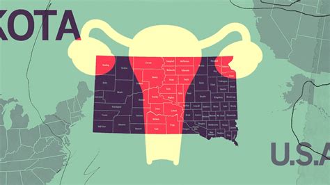 South Dakota Abortion Laws: What It's Like to Get an Abortion in South Dakota