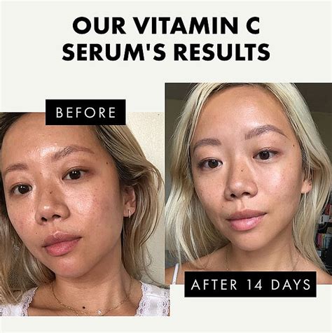 This vegan vitamin C serum leaves skin brighter, glowing, and free of ...