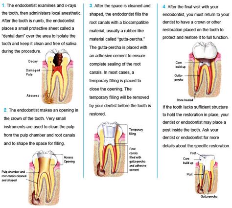 Endodontic Treatment - Dr. Gamson