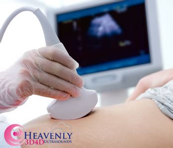 3D and 4D Baby Ultrasound – Heavenly 3D 4D Ultrasound