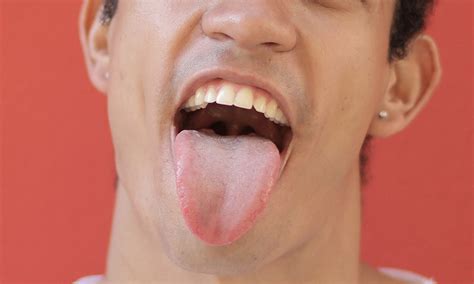 Coated tongue: Symptoms, causes, treatment | CURAPROX