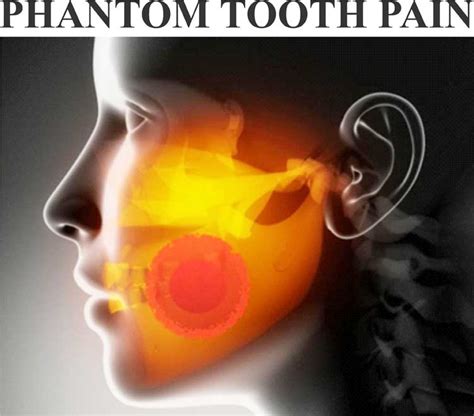 phantom-tooth-pain – Kaieteur News