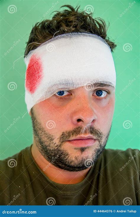 Young man with head injury stock photo. Image of head - 44464376