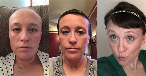 Thinning Hair From Chemo Hair Styles : 6 Months Post Chemo Hair Growth ...