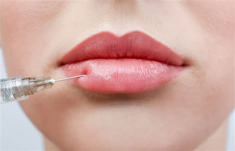 Lip Injection: How Does It Work & How Long Does It Last? | Torrance, CA