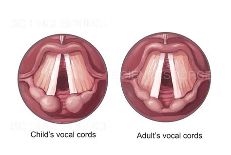 Child and Adult Vocal Chords, Illustra | Stock Image - Science Source ...