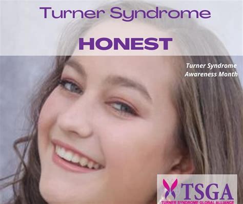 Turner Syndrome, Encouragement, Wedding Ring