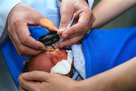 Community Eye Health Journal » Retinopathy of prematurity: it is time ...
