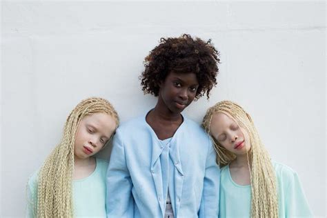 Lara And Mara The Albino Twin Models From Brazil Are The Talk Of The ...