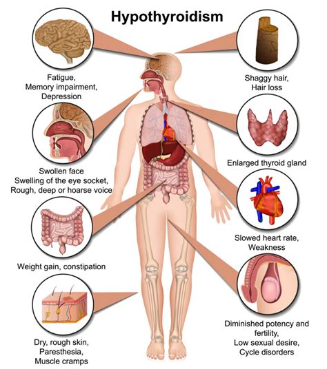 Signs Of Common Hormonal Imbalances In Men