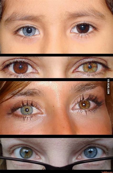 Heterochromia Iridis * - Heterochromia (Greek : heteros 'different' + chromia 'color') of the ...