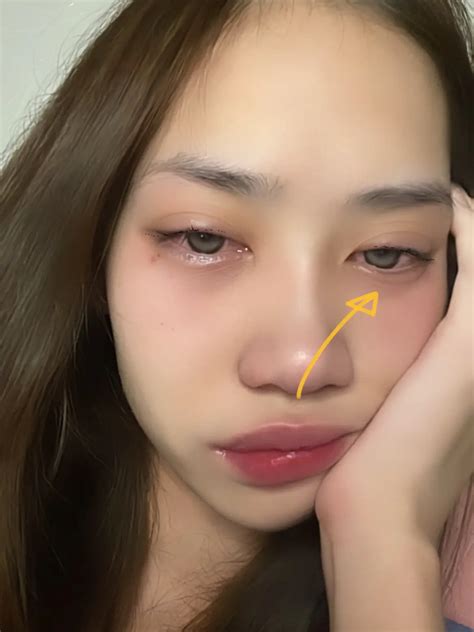 HOWTO minus under swollen eyes🥺 | Gallery posted by SAKUNIT | Lemon8