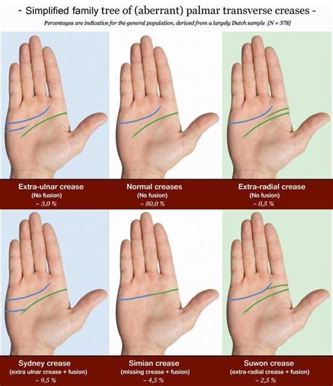 INTRO (1/14): About the single palmar transverse crease & the impact of a (harmless) minor ...