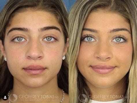 Gia Giudice got a nose job -- Check out the RHONJ daughter's before and ...