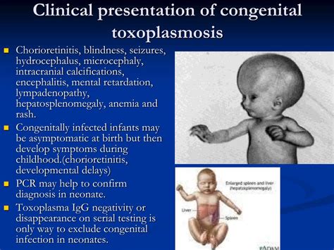 PPT - Toxoplasmosis in twenty minutes PowerPoint Presentation, free download - ID:1443632