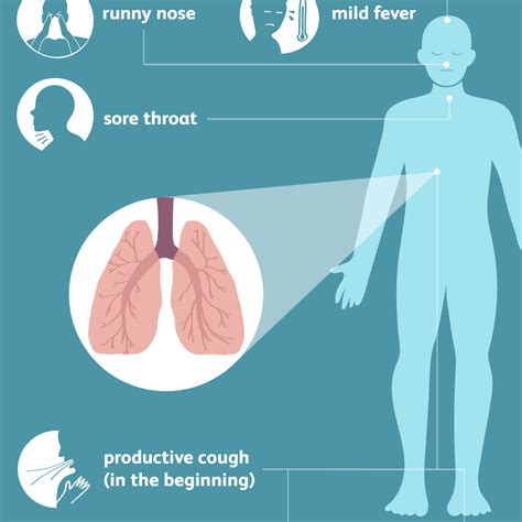 Should You Exercise When You Have Bronchitis - Exercise Poster