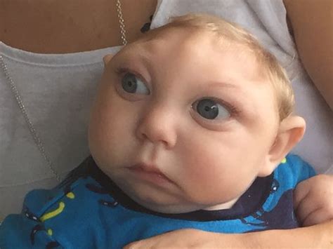 Baby born missing most of brain proves doctors wrong | wtsp.com