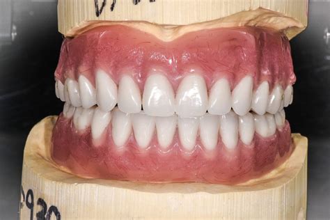 Full Dentures • Triad Dental Studio