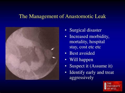 PPT - The Management of Anastomotic Leak PowerPoint Presentation, free download - ID:581519